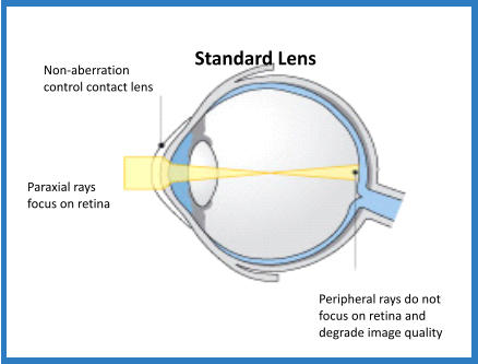 Standard Lens Non-aberration control contact lens Paraxial rays focus on retina Peripheral rays do not focus on retina and degrade image quality
