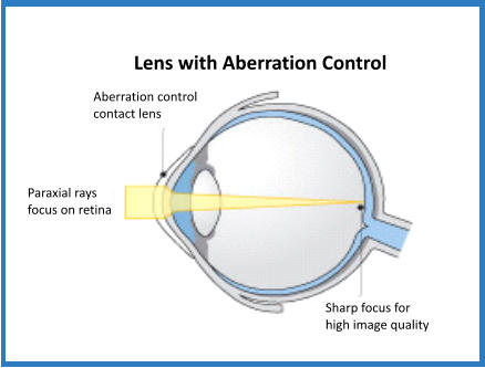 Lens with Aberration Control Aberration control  contact lens Paraxial rays focus on retina Sharp focus for high image quality